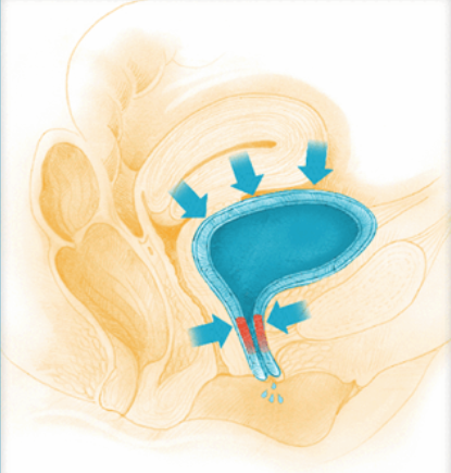 Ανατομία ουροδόχου κύστης - ακράτεια ούρων - Δρ. Μερτζιώτης Ουρολόγος Αθήνα