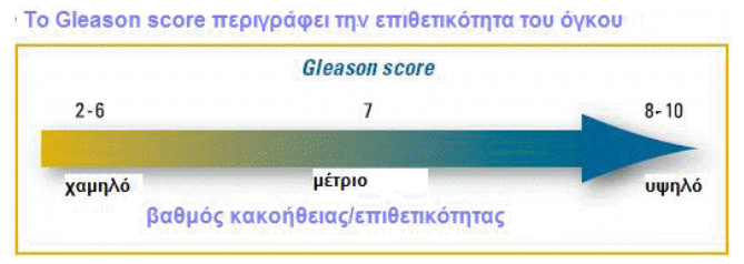 Gleason score - βαθμός κακοήθειας καρκίνου προστάτη - Δρ. Μερτζιώτης Ουρολόγος Αθήνα
